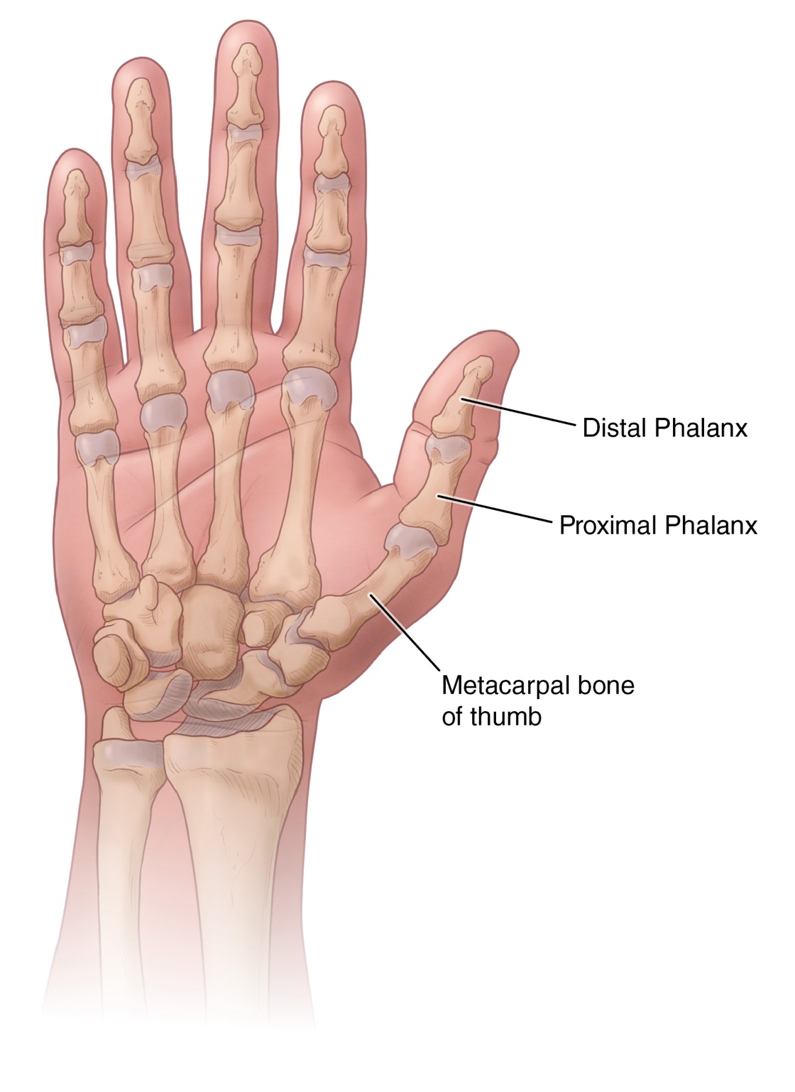 Thumb Fracture Q A