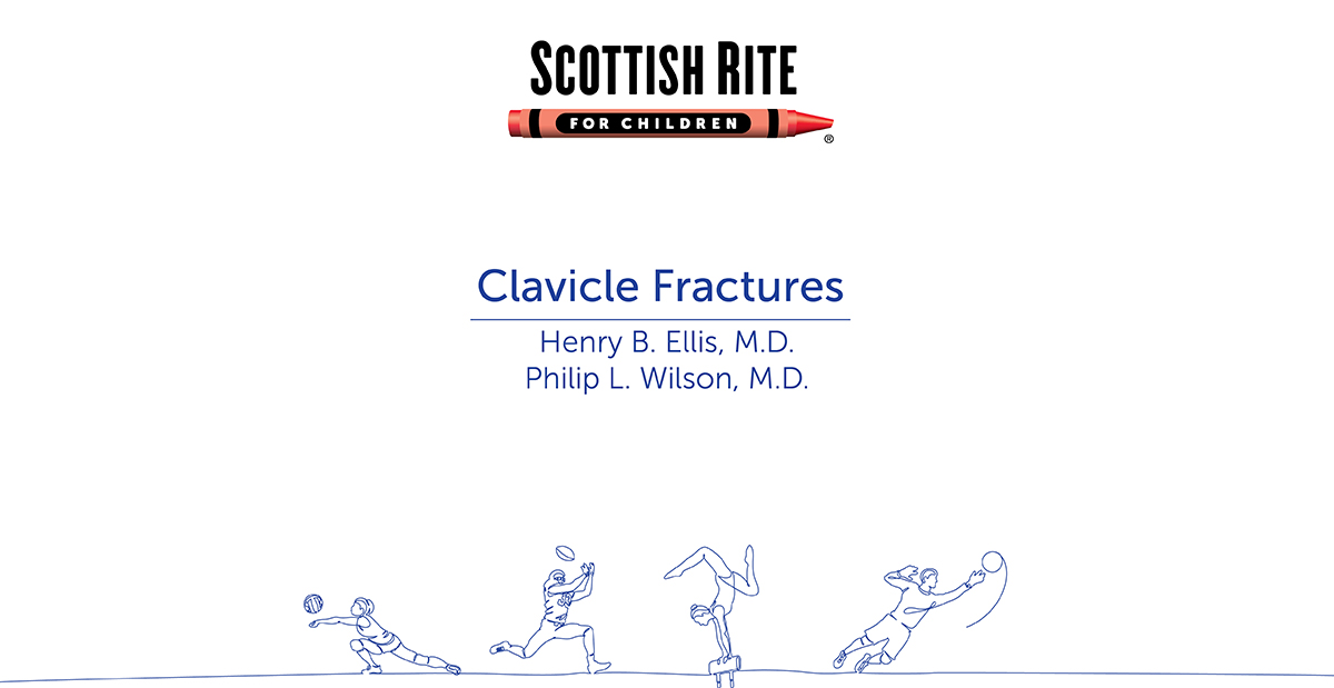 clavicle fractures