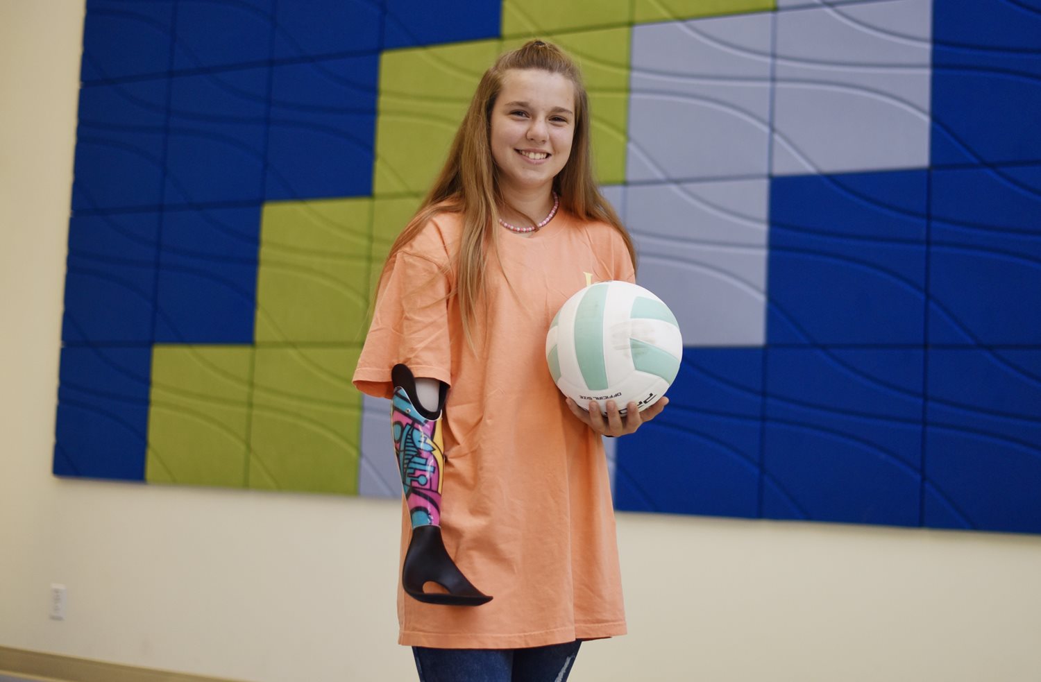 Patient with volleyball and fashionable prosthetic arm