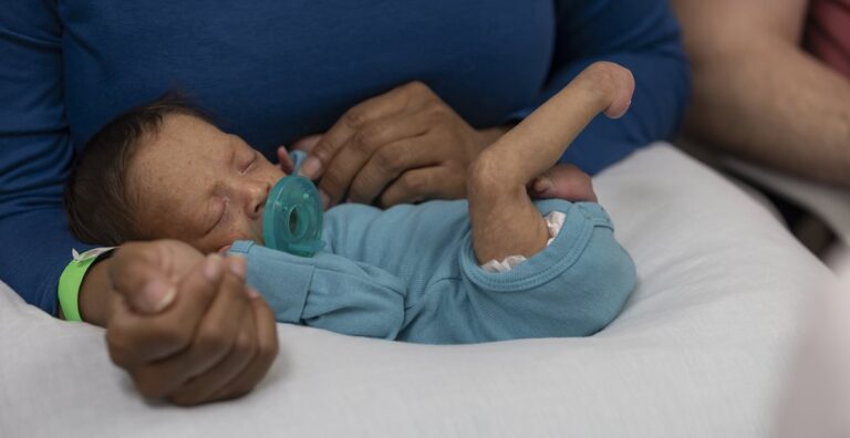 Clubfoot Treatment: What Are Your Child’s Options?