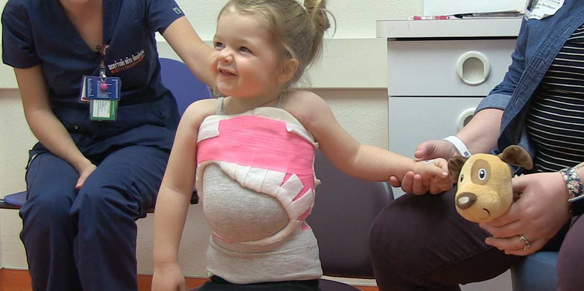 A casting patient during an appointment.