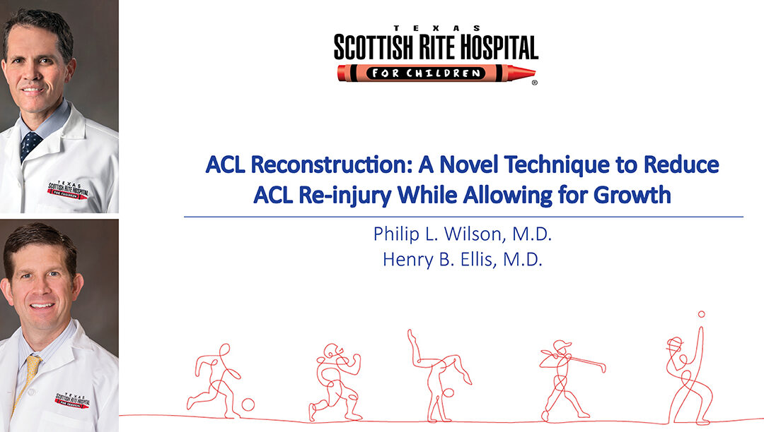 A New Approach in ACL Reconstruction Helps to Reduce Re-injury in High Risk Population