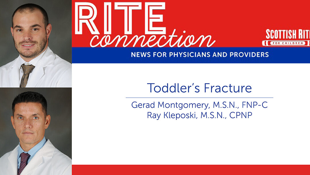 An Approach to Management of Toddler’s Fractures