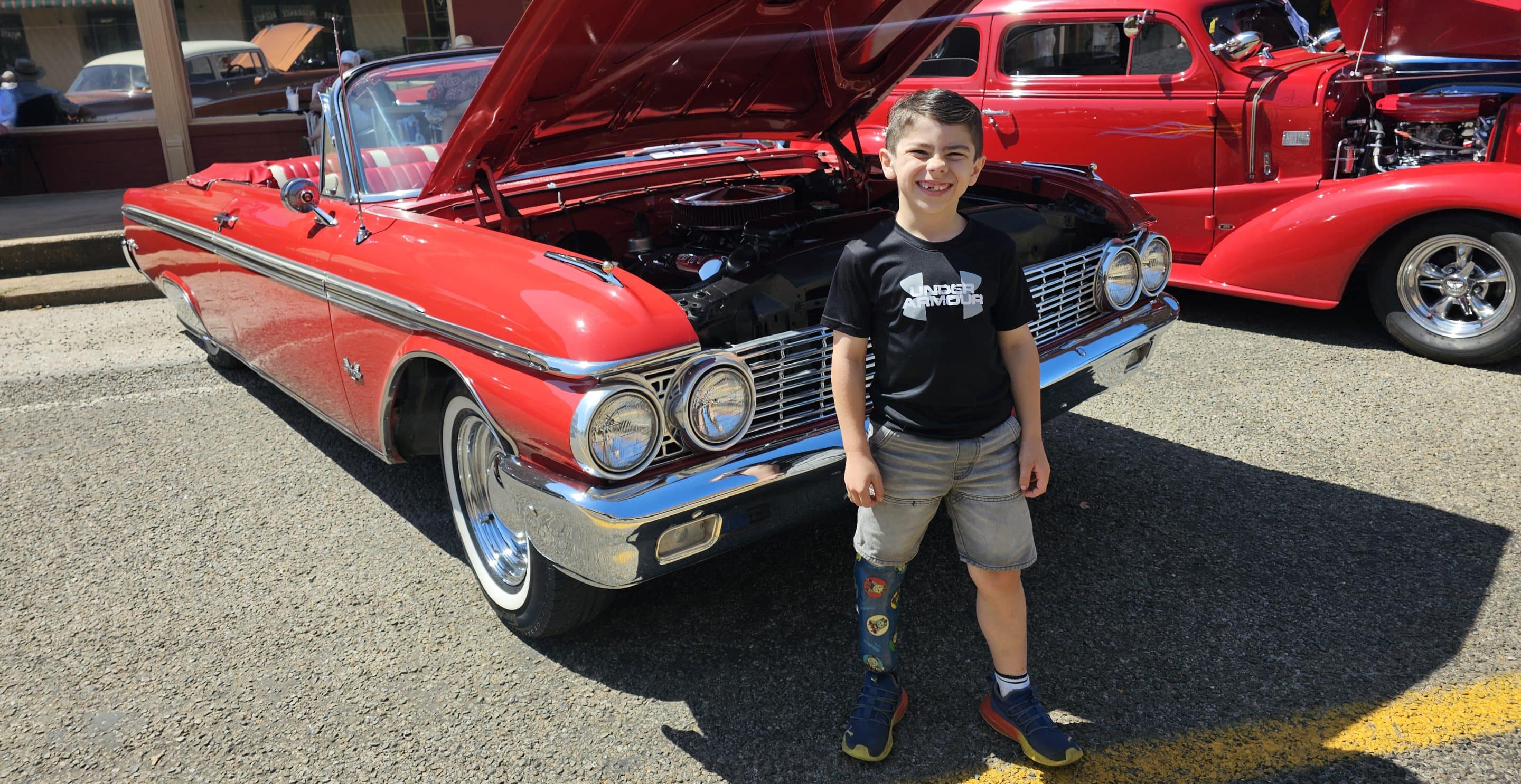 How Ryan Lives Life to the Fullest With A Limb Difference