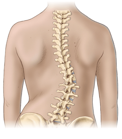 Curved spine